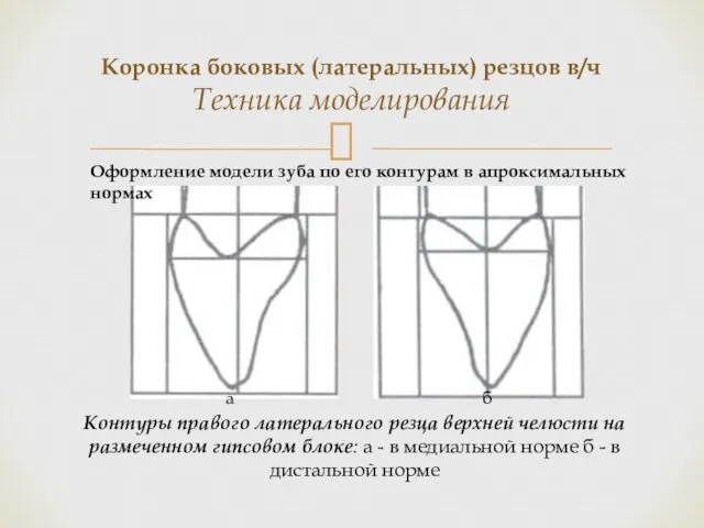 Коронка боковых (латеральных) резцов в/ч Техника моделирования Контуры правого латерального резца