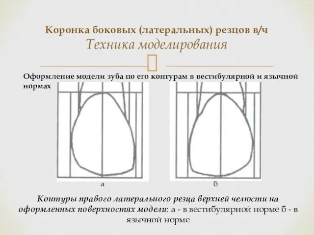 Коронка боковых (латеральных) резцов в/ч Техника моделирования Контуры правого латерального резца