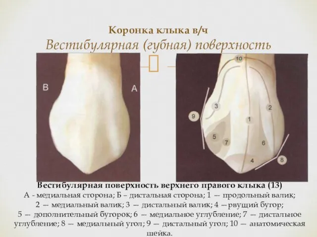 Коронка клыка в/ч Вестибулярная (губная) поверхность Вестибулярная поверхность верхнего правого клыка