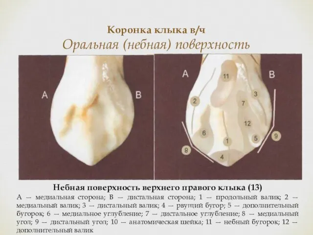 Коронка клыка в/ч Оральная (небная) поверхность Небная поверхность верхнего правого клыка