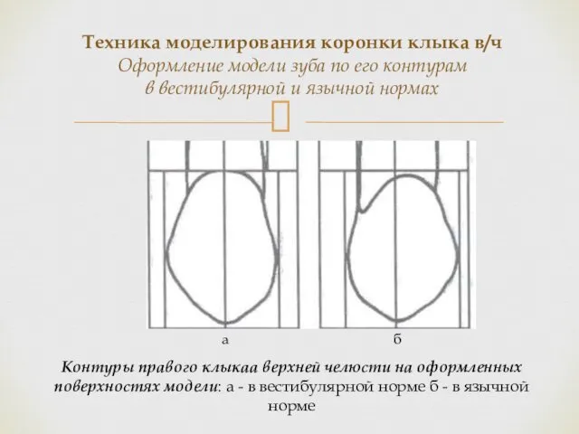 Контуры правого клыкаа верхней челюсти на оформленных поверхностях модели: а -