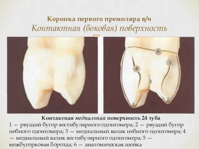 Коронка первого премоляра в/ч Контактная (боковая) поверхность Контактная медиальная поверхность 24