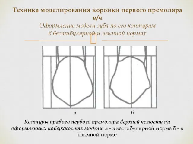 Контуры правого первого премоляра верхней челюсти на оформленных поверхностях модели: а