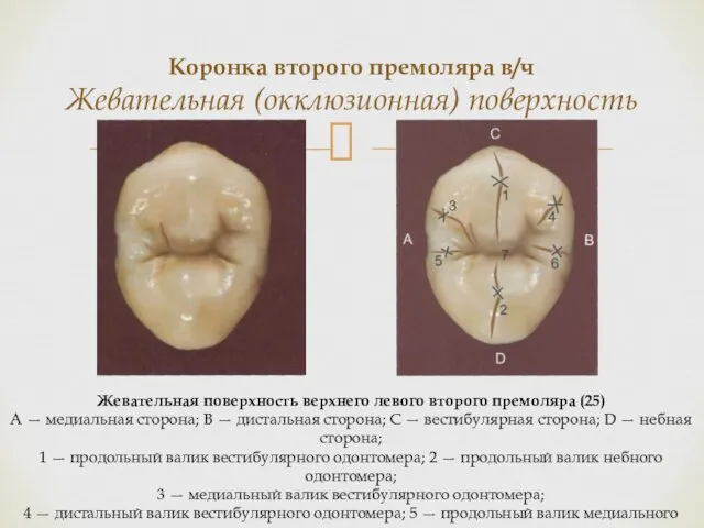 Коронка второго премоляра в/ч Жевательная (окклюзионная) поверхность Жевательная поверхность верхнего левого