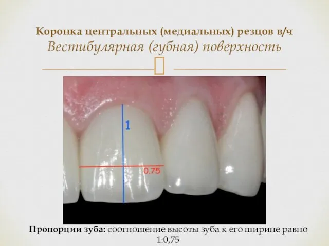 Коронка центральных (медиальных) резцов в/ч Вестибулярная (губная) поверхность Пропорции зуба: соотношение