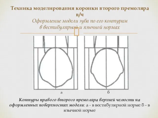 Контуры правого второго премоляра верхней челюсти на оформленных поверхностях модели: а