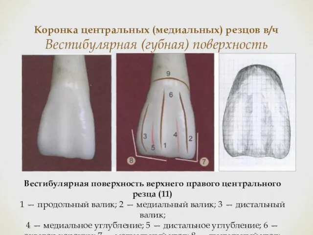 Коронка центральных (медиальных) резцов в/ч Вестибулярная (губная) поверхность Вестибулярная поверхность верхнего