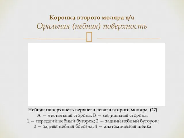 Коронка второго моляра в/ч Оральная (небная) поверхность Небная поверхность верхнего левого