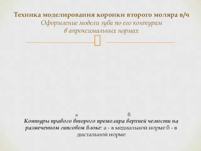 Контуры правого второго премоляра верхней челюсти на размеченном гипсовом блоке: а