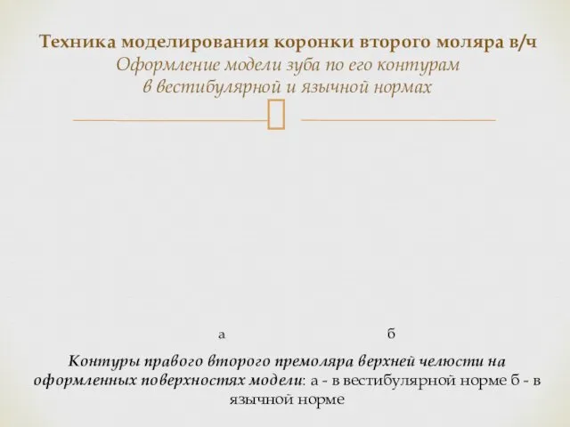 Контуры правого второго премоляра верхней челюсти на оформленных поверхностях модели: а