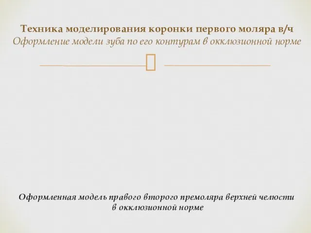 Техника моделирования коронки первого моляра в/ч Оформление модели зуба по его