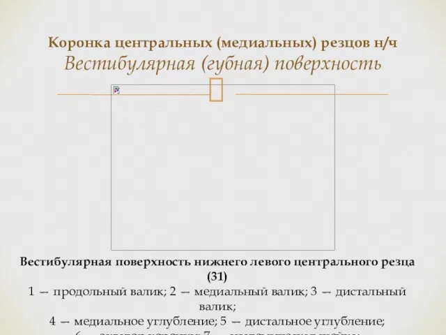 Коронка центральных (медиальных) резцов н/ч Вестибулярная (губная) поверхность Вестибулярная поверхность нижнего