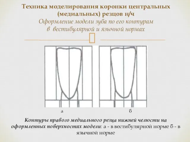 Контуры правого медиального резца нижней челюсти на оформленных поверхностях модели: а