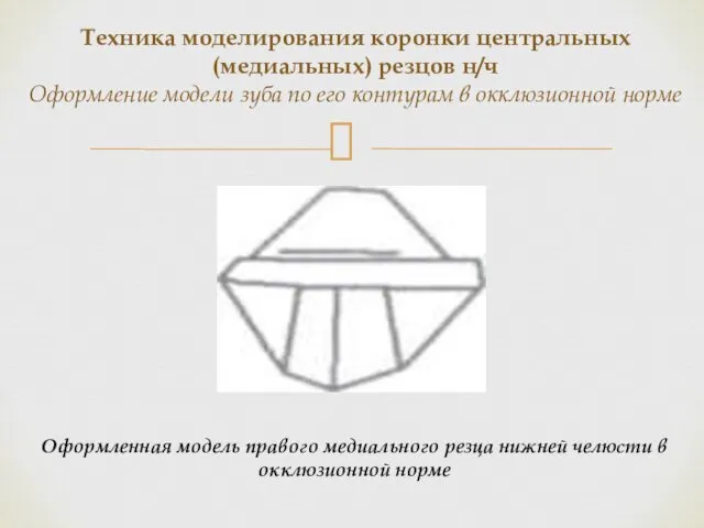 Оформленная модель правого медиального резца нижней челюсти в окклюзионной норме Техника