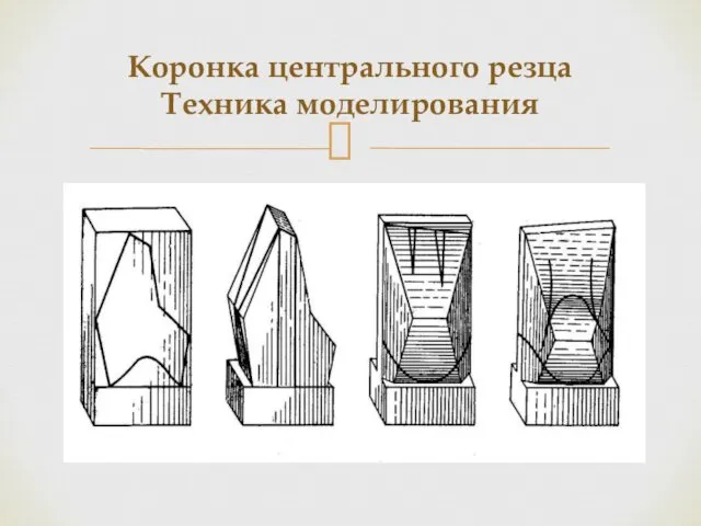 Коронка центрального резца Техника моделирования