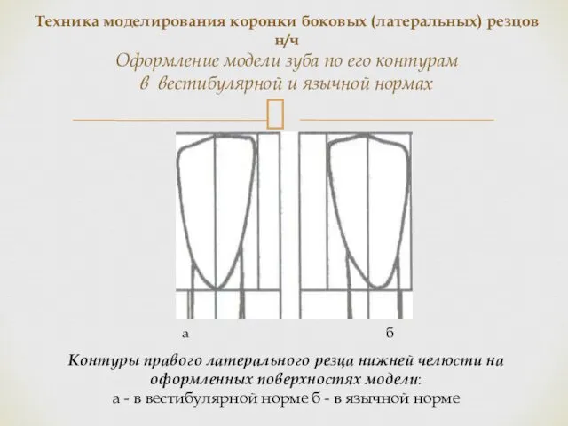 Контуры правого латерального резца нижней челюсти на оформленных поверхностях модели: а