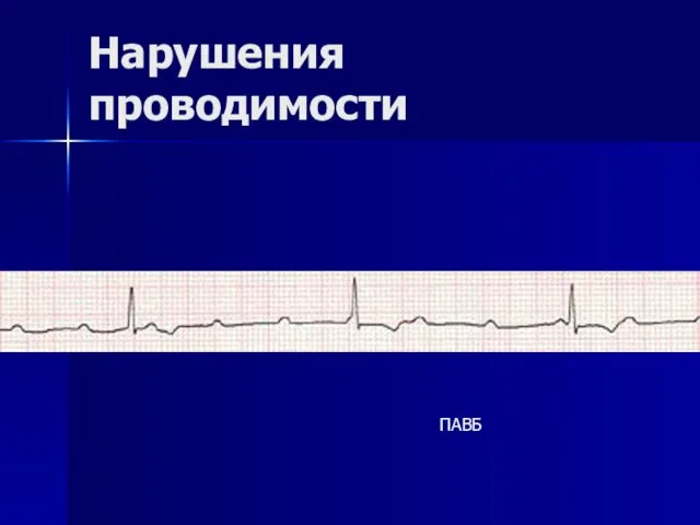 Нарушения проводимости ПАВБ