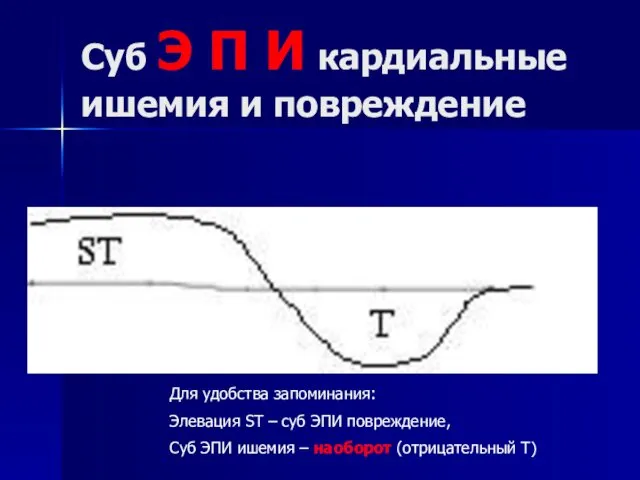 Суб Э П И кардиальные ишемия и повреждение Для удобства запоминания: