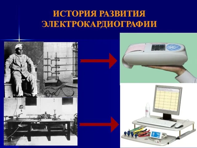 ИСТОРИЯ РАЗВИТИЯ ЭЛЕКТРОКАРДИОГРАФИИ