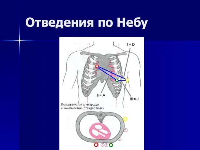 Отведения по Небу