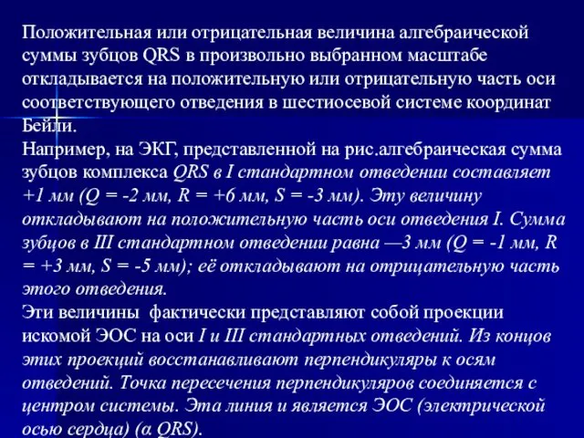 Положительная или отрицательная величина алгебраической суммы зубцов QRS в произвольно выбранном