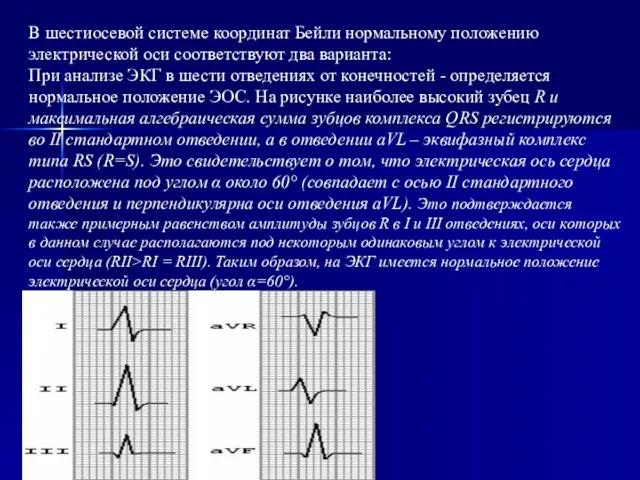 В шестиосевой системе координат Бейли нормальному положению электрической оси соответствуют два