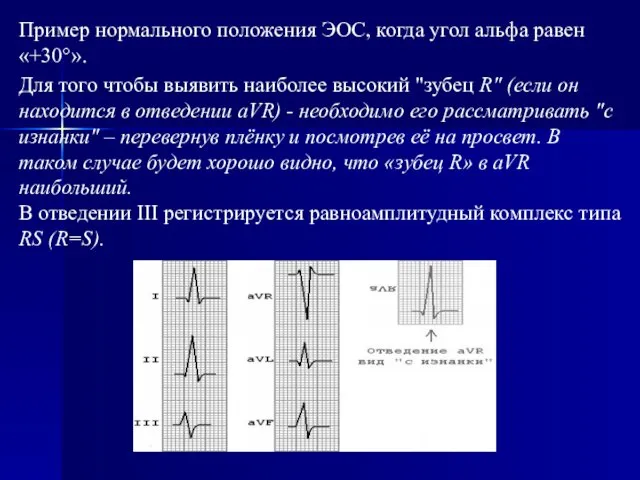 Пример нормального положения ЭОС, когда угол альфа равен «+30°». Для того