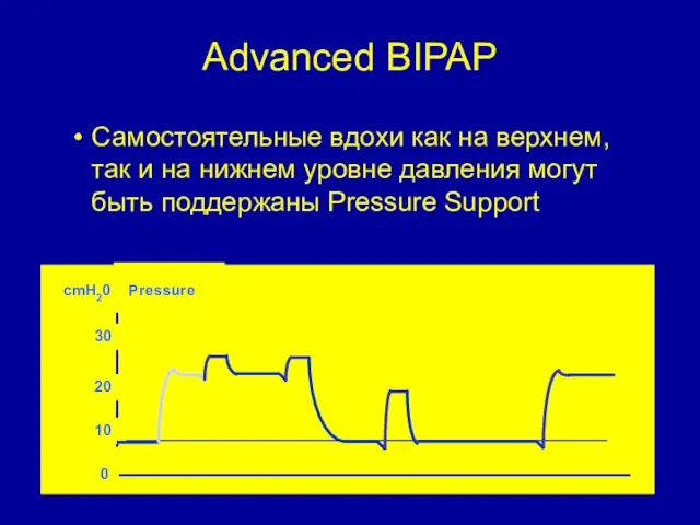 Advanced BIPAP Самостоятельные вдохи как на верхнем, так и на нижнем