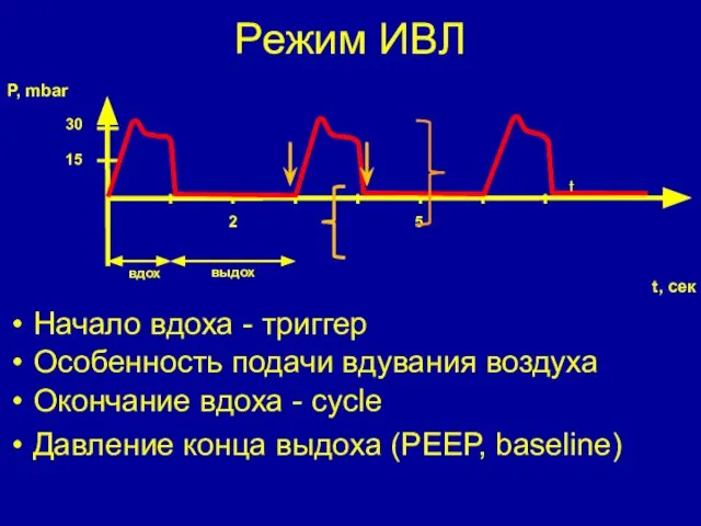 Режим ИВЛ Начало вдоха - триггер Особенность подачи вдувания воздуха Окончание