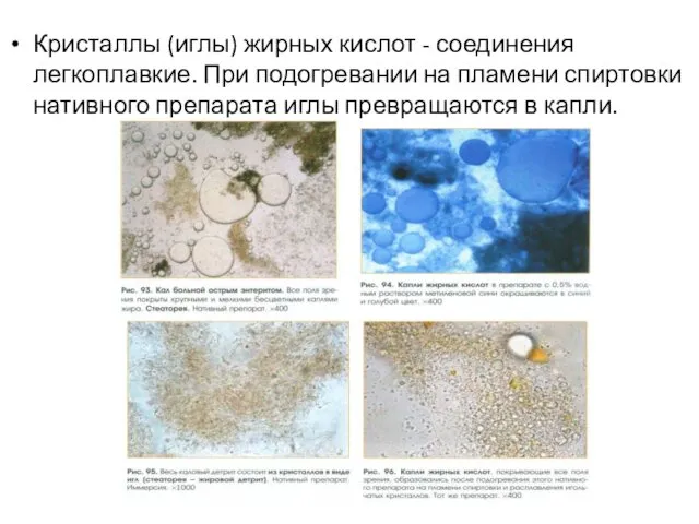 Кристаллы (иглы) жирных кислот - соединения легкоплавкие. При подогревании на пламени