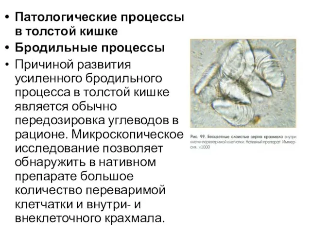 Патологические процессы в толстой кишке Бродильные процессы Причиной развития усиленного бродильного