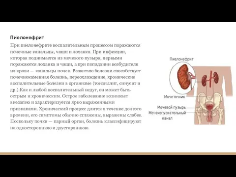 Пиелонефрит При пиелонефрите воспалительным процессом поражаются почечные канальцы, чаши и лоханка.