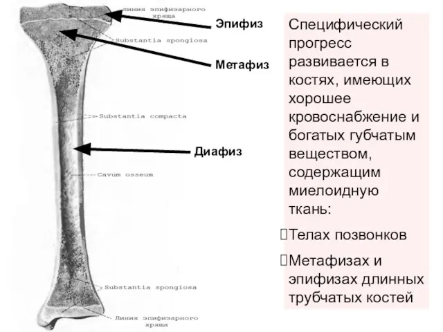 Эпифиз Метафиз Диафиз Специфический прогресс развивается в костях, имеющих хорошее кровоснабжение