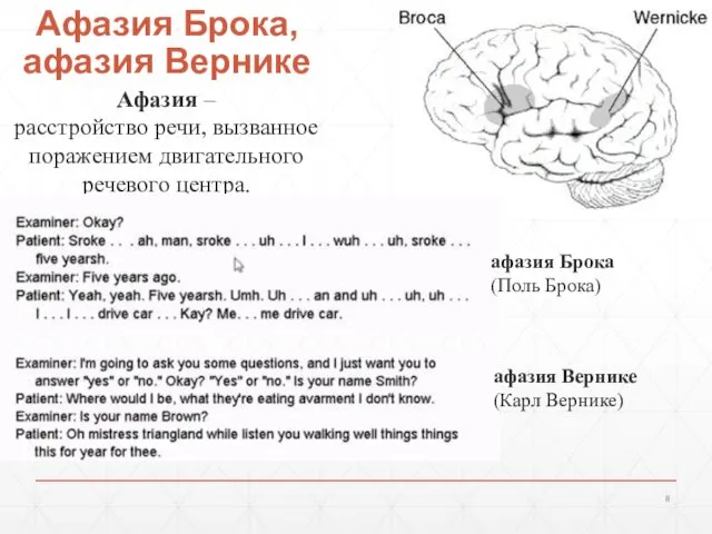 Афазия Брока, афазия Вернике Афазия – расстройство речи, вызванное поражением двигательного