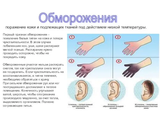 Обморожения поражение кожи и подлежащих тканей под действием низкой температуры. Первый