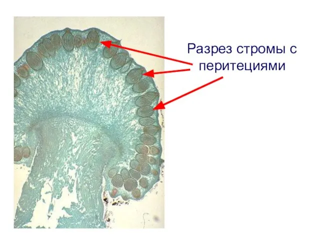 Разрез стромы с перитециями