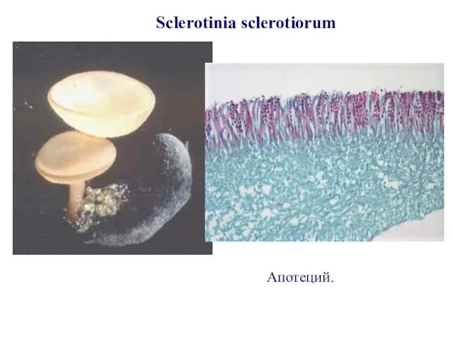 Sclerotinia sclerotiorum Апотеций.