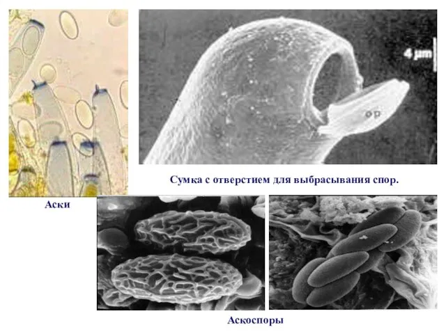 Аски Сумка с отверстием для выбрасывания спор. Аскоспоры