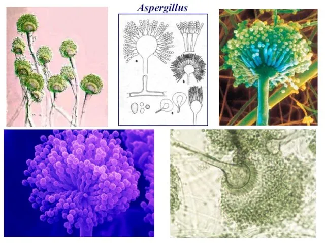 Aspergillus