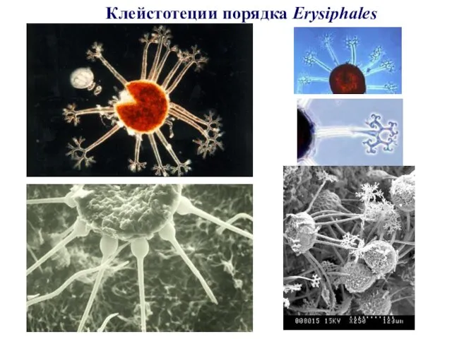 Клейстотеции порядка Erysiphales