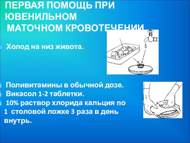 ПЕРВАЯ ПОМОЩЬ ПРИ ЮВЕНИЛЬНОМ МАТОЧНОМ КРОВОТЕЧЕНИИ Холод на низ живота. Поливитамины