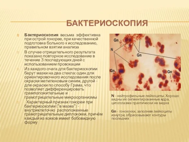 БАКТЕРИОСКОПИЯ Бактериоскопия весьма эффективна при острой гонорее, при качественной подготовке больного