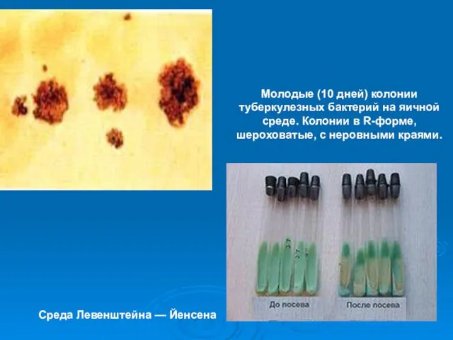 Молодые (10 дней) колонии туберкулезных бактерий на яичной среде. Колонии в