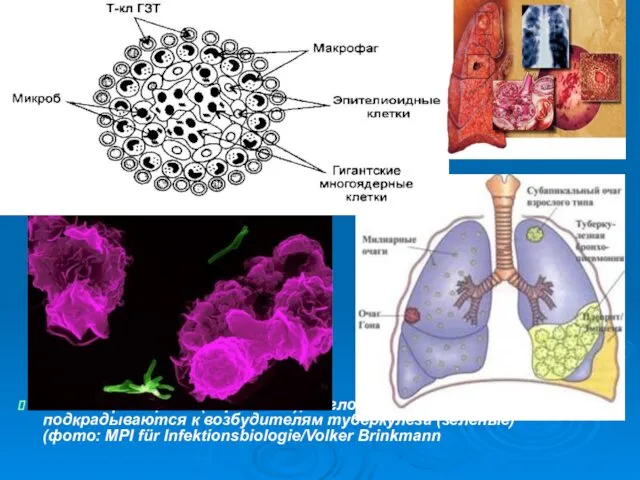Клетки фагоциты (сиреневые), поглощающие чужеродные частицы, подкрадываются к возбудителям туберкулеза (зеленые) (фото: MPI für Infektionsbiologie/Volker Brinkmann