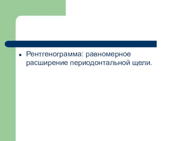 Рентгенограмма: равномерное расширение периодонтальной щели.