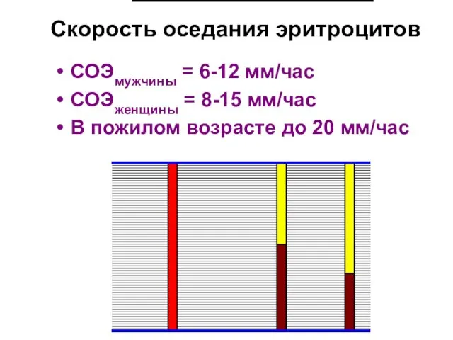 Скорость оседания эритроцитов СОЭмужчины = 6-12 мм/час СОЭженщины = 8-15 мм/час