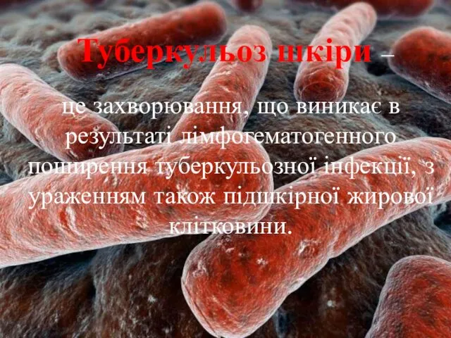 Туберкульоз шкіри – це захворювання, що виникає в результаті лімфогематогенного поширення