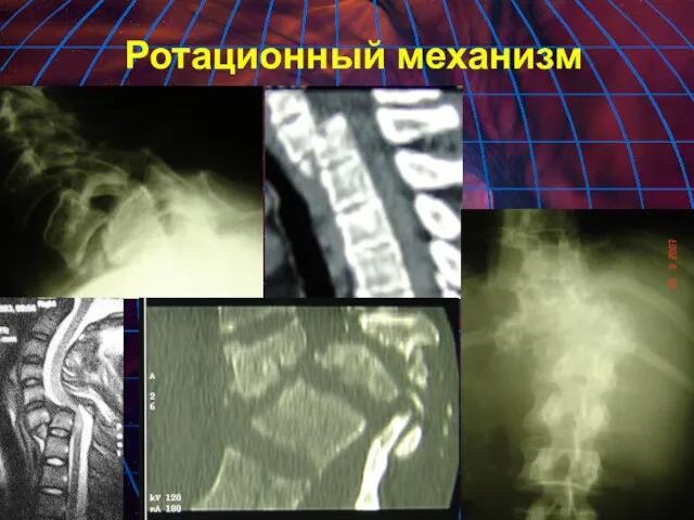 Ротационный механизм