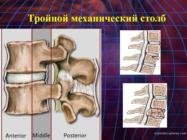 Тройной механический столб