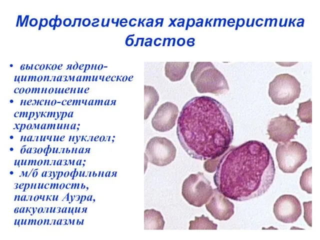 Морфологическая характеристика бластов высокое ядерно-цитоплазматическое соотношение нежно-сетчатая структура хроматина; наличие нуклеол;